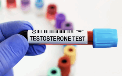Testosterone Talk Is Everywhere But What About Your Levels?
